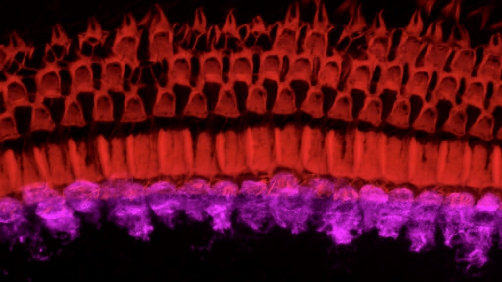 Confocal microscope image of a whole mount preparation of a mouse cochlea showing the cochlear hair cells. The inner hair cells (bottom) are responsible for the mechano-transduction of sound into an electrical signal and are stained in magenta (Vglut3), while the three rows of outer hair cells are labeled in red (phalloidin).  Note that some of the outer hair cells in the outermost row (top) are missing.