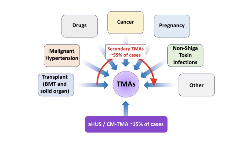 TMA